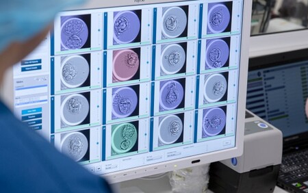 Laboratories and embryoscope that create success