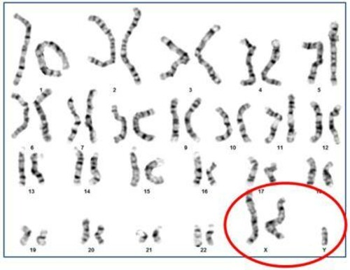 chromosome variation